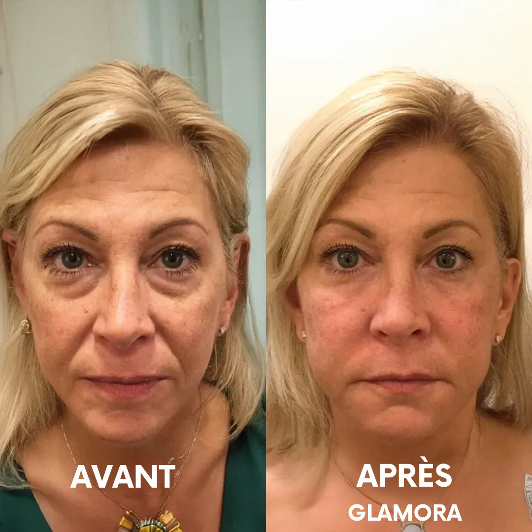 Glamora - Calcium Lift Stick