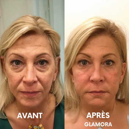 Glamora - Calcium Lift Stick